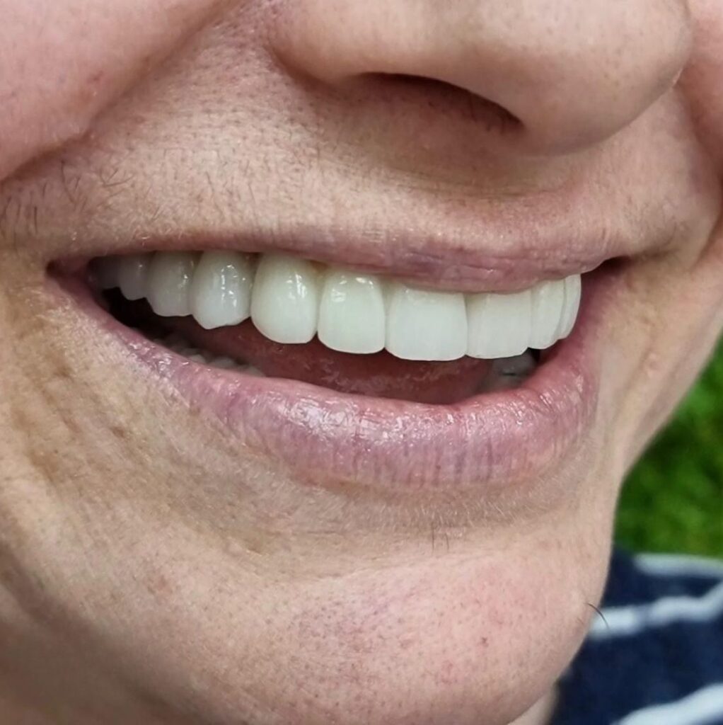 fabricantes de carga inmediata