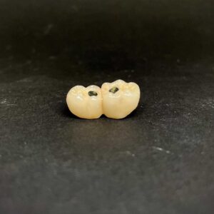 corona dental zirconio