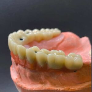 protesis dental