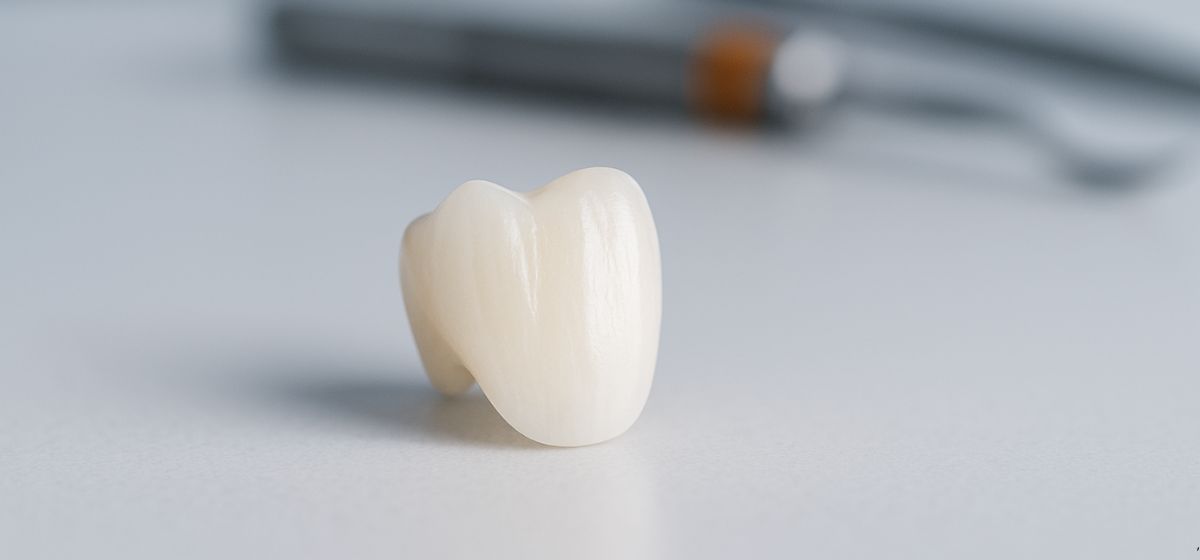 zirconio.dental.estetico
